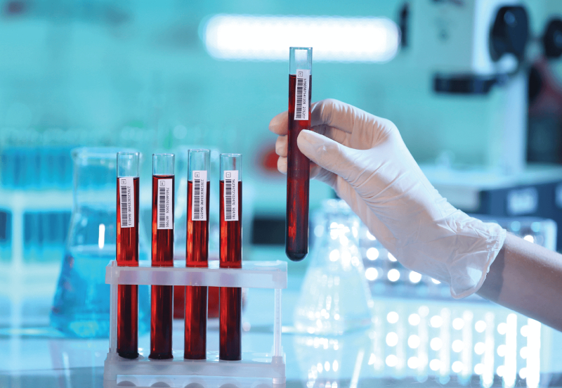 best blood test center in Goa